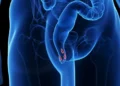 ¡Alerta! Tu zona anal podría estar en riesgo y no lo sabes