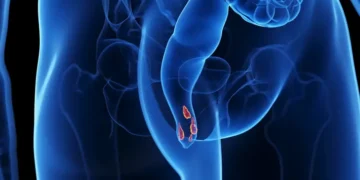 ¡Alerta! Tu zona anal podría estar en riesgo y no lo sabes