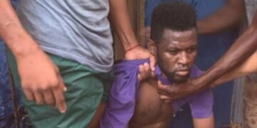 Brutal agresión en Puerto Plata: Hombre hiere de gravedad a expareja