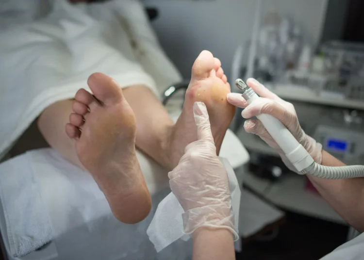 Tus pies te lo dicen: ¿Diabetes o mala circulación