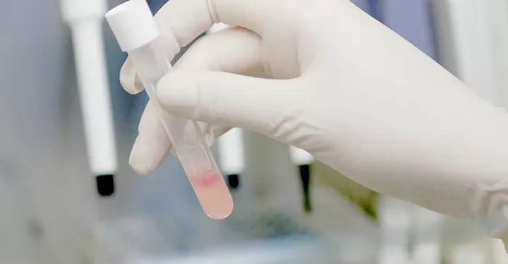 ¡Revolución! Tu saliva podría predecir la evolución del cáncer de cabeza y cuello