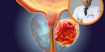 ¡Alerta Vital! Oncólogo Confirma: Detección Temprana Vence al Cáncer de Próstata y Salva Tu Vida
