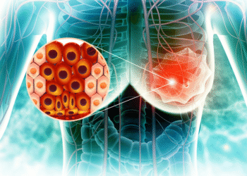 AVANCE CLAVE: Fármaco oncológico contra cáncer de mama arroja resultados muy prometedores
