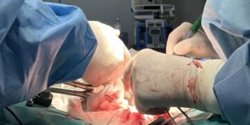 Primer trasplante exitoso: Cerdos reciben riñones ‘híbridos’ con organoides humanos