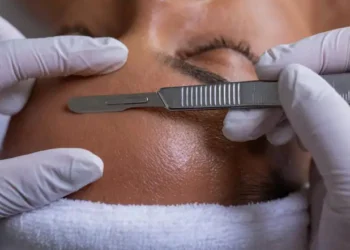 ¡Alerta! Expertos desaconsejan esta moda estética viral