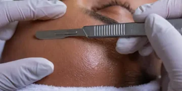 ¡Alerta! Expertos desaconsejan esta moda estética viral