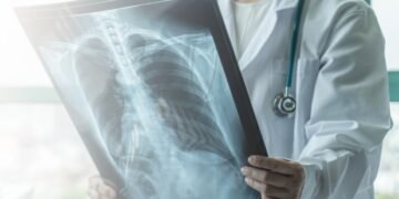 El Secreto del Neumólogo: Claves Imprescindibles para Pulmones Sanos