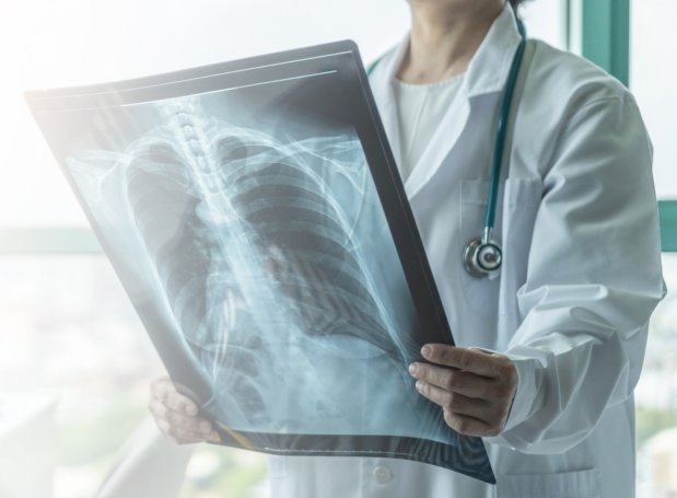 El Secreto del Neumólogo: Claves Imprescindibles para Pulmones Sanos