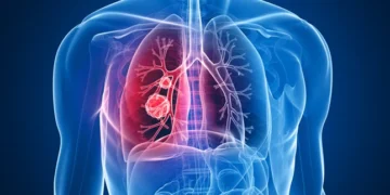 ¡Giro médico en RD! Fármaco accesible demuestra ser un arma clave contra varios cánceres