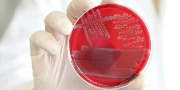 Encuentran el ‘interruptor maestro’ que tu cuerpo usa para apagar la inflamación