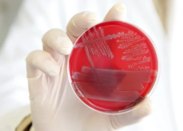 Encuentran el ‘interruptor maestro’ que tu cuerpo usa para apagar la inflamación