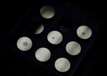 Detectan el primer caso en el mundo de una enfermedad rara transmitida por un donante de esperma