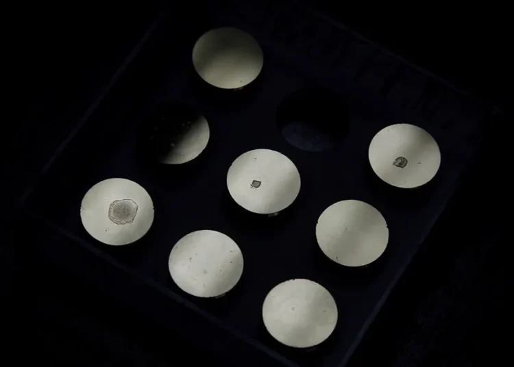 Detectan el primer caso en el mundo de una enfermedad rara transmitida por un donante de esperma