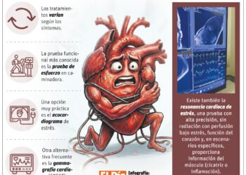 Dime qué sientes y te diré qué estudio cardiovascular necesitas