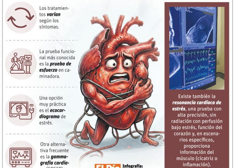 Dime qué sientes y te diré qué estudio cardiovascular necesitas