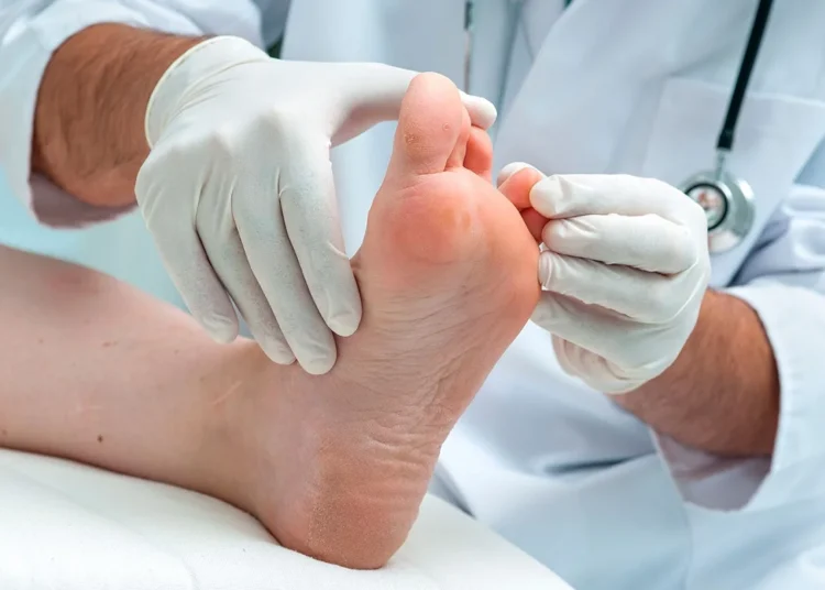 Cómo prevenir amputaciones por pie diabético: expertos revelan las claves en congreso internacional