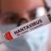 Alerta sanitaria: confirman un nuevo caso de hantavirus y la cifra asciende a 6 afectados