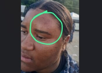 Caos en San Juan: Capitán de la FARD y una agente policial heridos durante protestas
