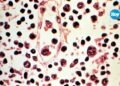 Hantavirus: confirman que contactos estrechos podrán cumplir cuarentena en casa