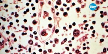 Hantavirus: confirman que contactos estrechos podrán cumplir cuarentena en casa