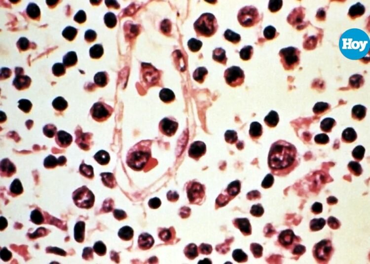 Hantavirus: confirman que contactos estrechos podrán cumplir cuarentena en casa