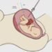 Hito médico en España: operan con éxito a un feto dentro del vientre materno para corregir una malformación intestinal