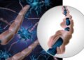 Esclerosis múltiple: la verdad sobre los tratamientos actuales ante la ausencia de una cura definitiva