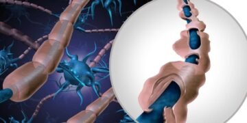 Esclerosis múltiple: la verdad sobre los tratamientos actuales ante la ausencia de una cura definitiva