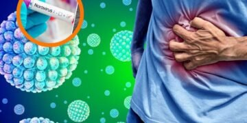 El virus que se confunde con una intoxicación alimentaria y dispara las alarmas en cruceros