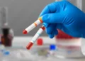 Ranking mundial: este es el lugar que ocupa el país en donación de sangre