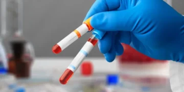 Ranking mundial: este es el lugar que ocupa el país en donación de sangre