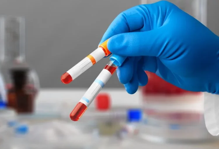 Ranking mundial: este es el lugar que ocupa el país en donación de sangre