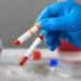 Ranking mundial: este es el lugar que ocupa el país en donación de sangre