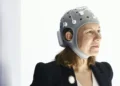 Este casco con electrodos es el invento que cambiará para siempre el tratamiento de enfermedades cerebrales